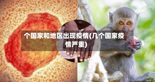 个国家和地区出现疫情(几个国家疫情严重)-第2张图片