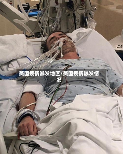 美国疫情暴发地区/美国疫情爆发情况-第3张图片